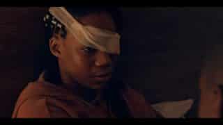 Lizzie (Shannon Hayes) after she lost her eye.