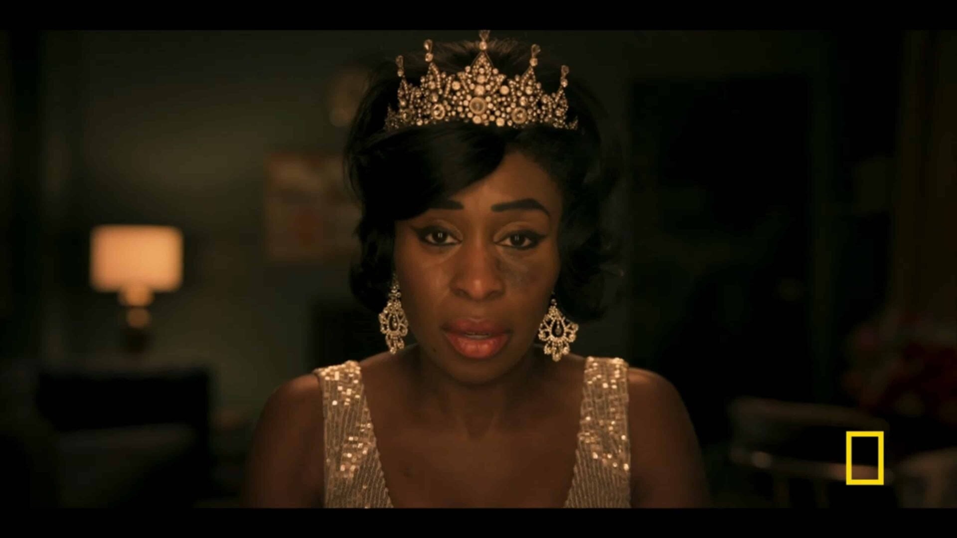 Aretha (Cynthia Erivo) after being crowned the Queen of Soul, with a bruise on her face caused by her husband
